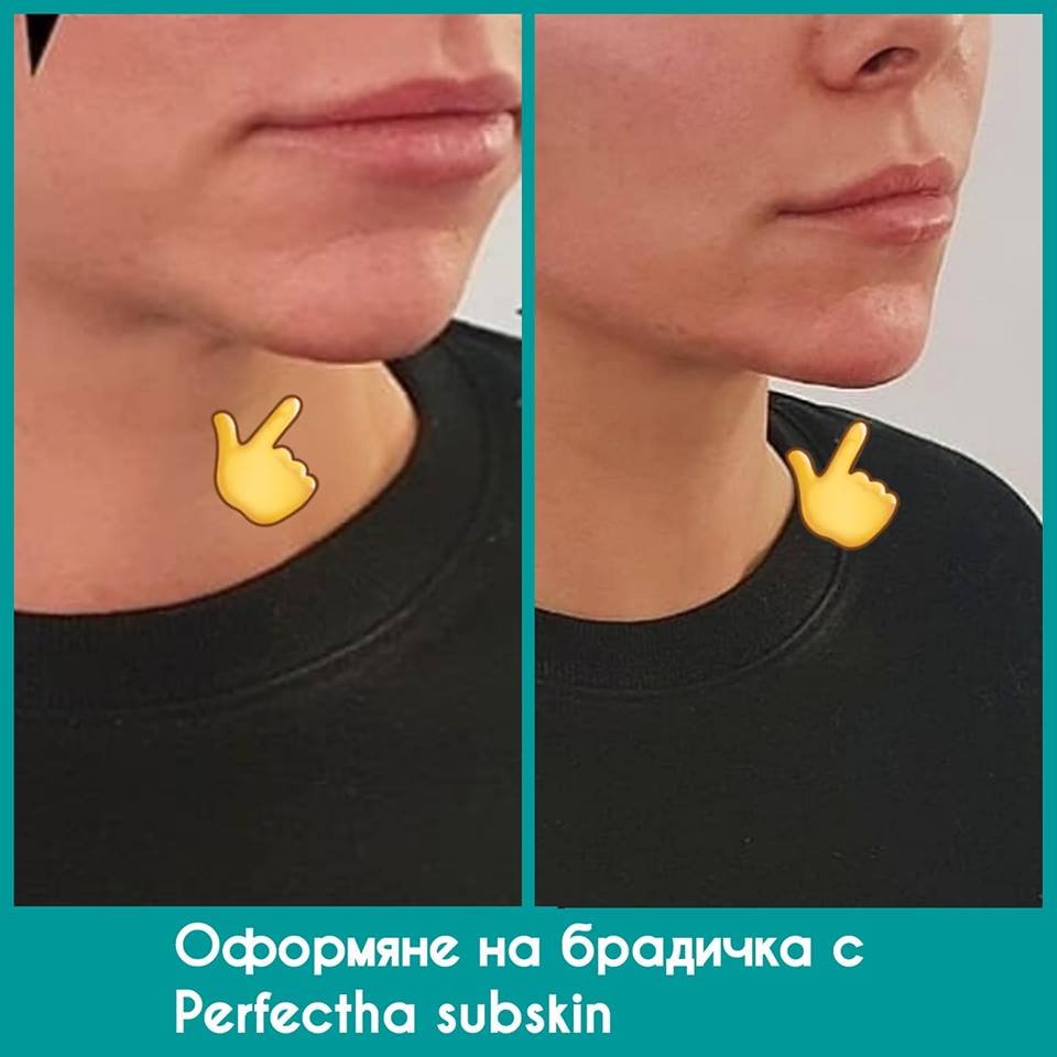 bradichka