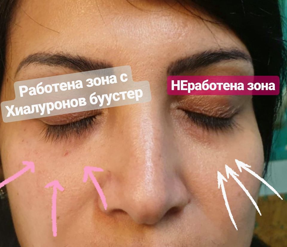 buuster-dr-nedelcheva3