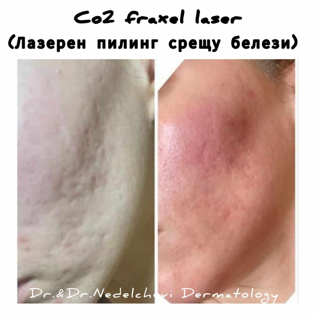 co2-laser-dr-nedecheva-241324