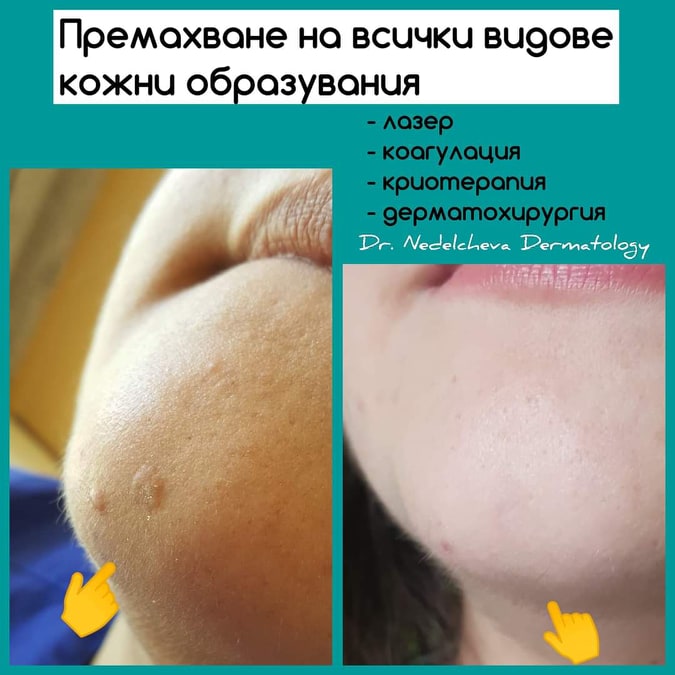 dermatologiyaDrDrNedelchevi11