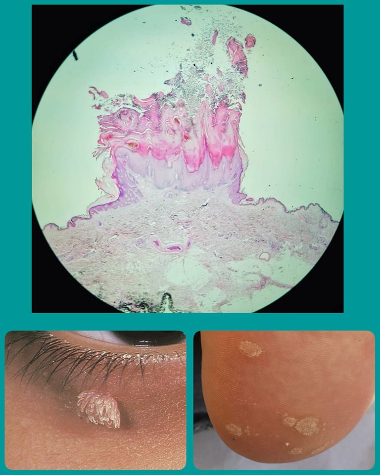dermatologiyaDrDrNedelchevi12