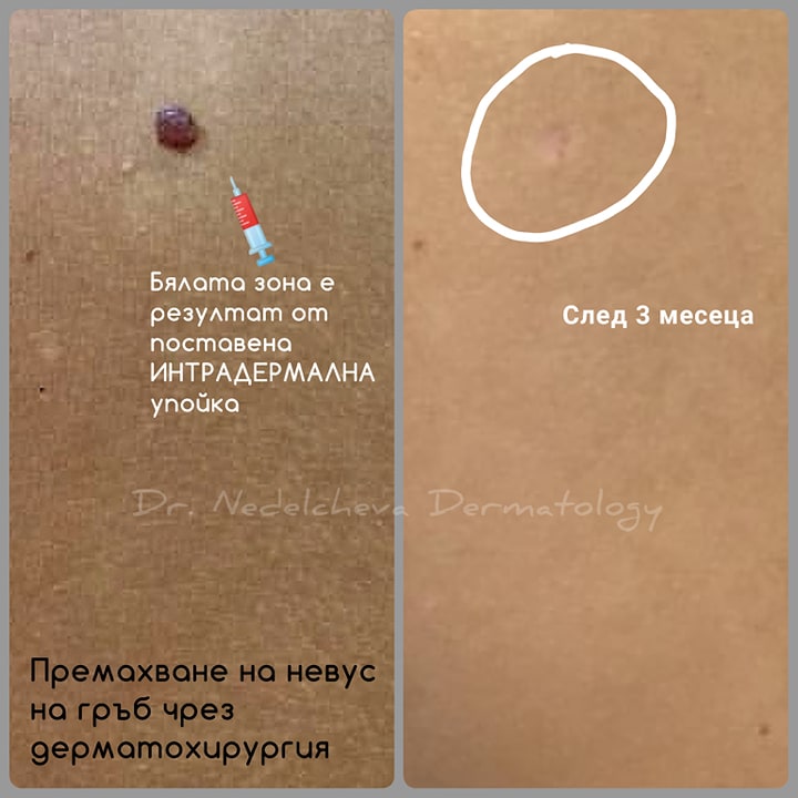 dermatologiyaDrDrNedelchevi3