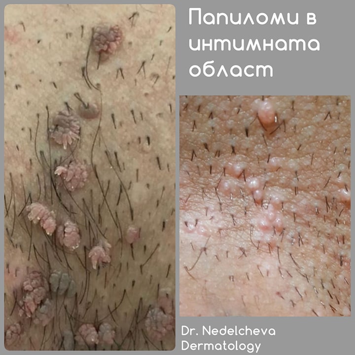 dermatologiyaDrDrNedelchevi4