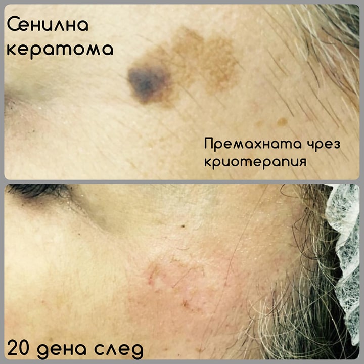 dermatologiyaDrDrNedelchevi5