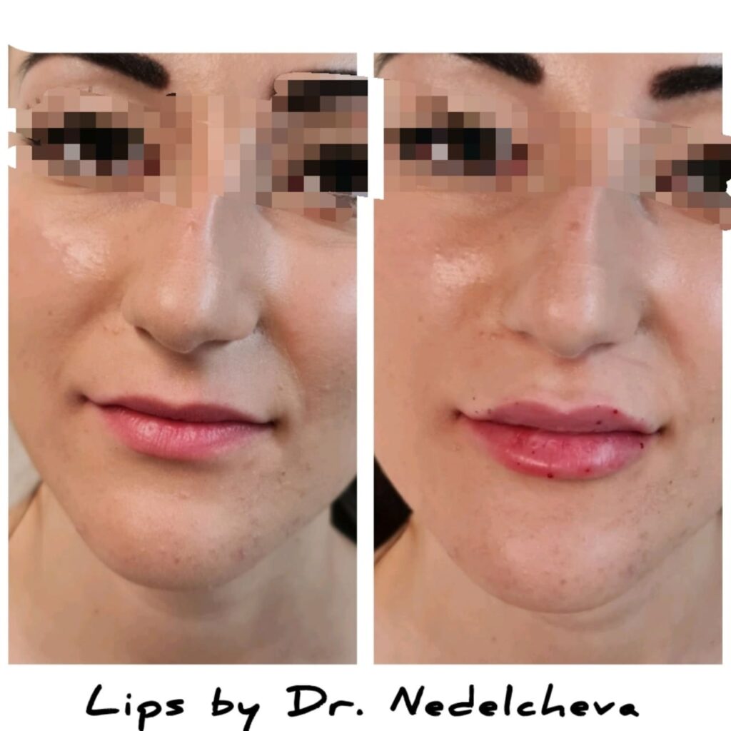 filar-ustni-dr-nedelcheva359