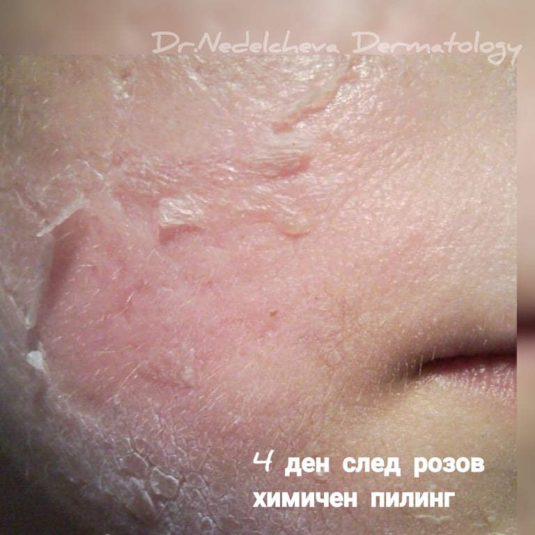 himi1en-piling-drnedelcheva