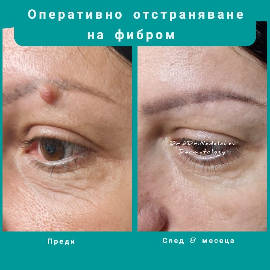 hirurgiya-dr-nedelcheva