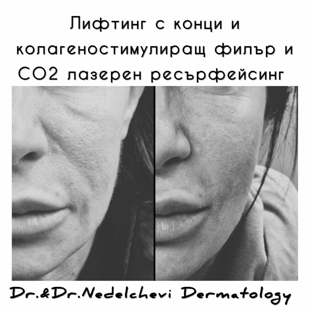 konci-dr-nedelcheva-234352