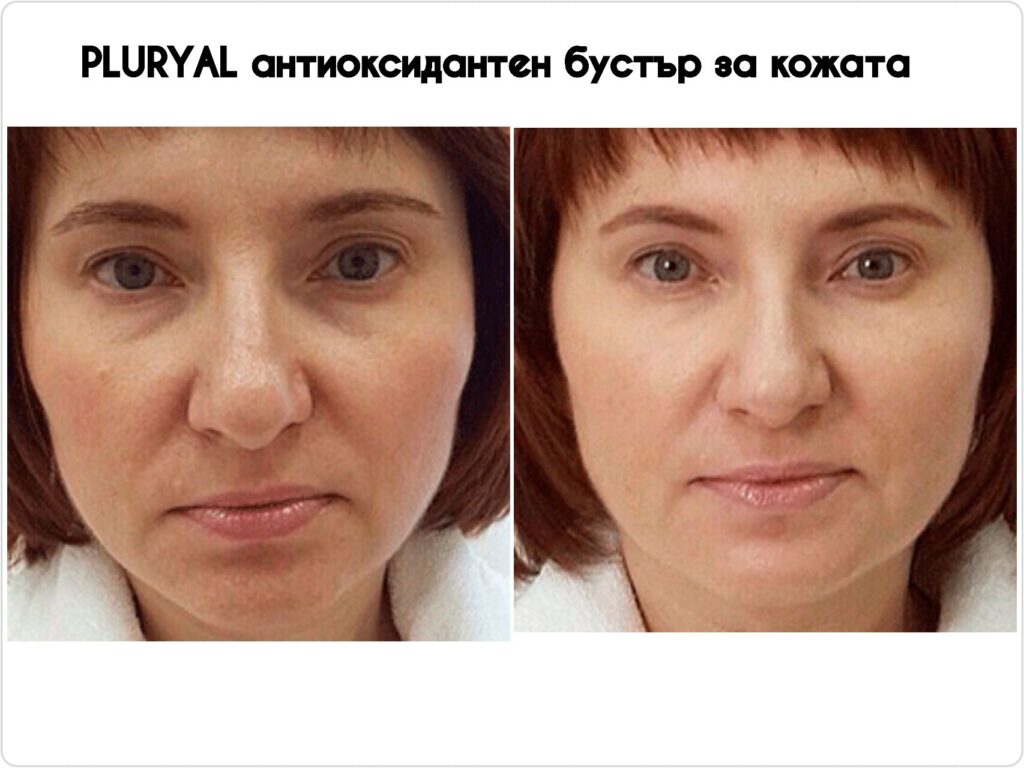 mezo1