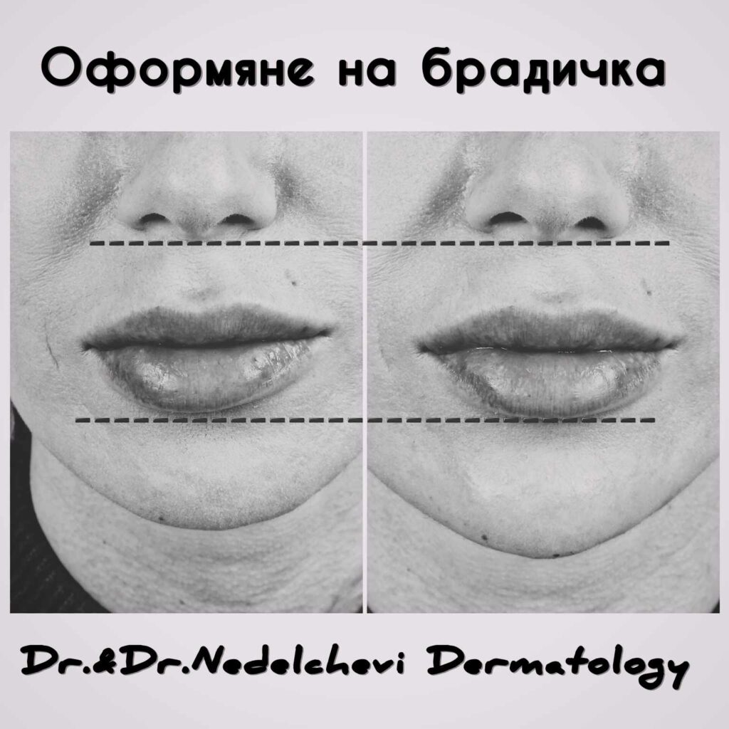 oformyane-bradichka-dr-nedelcheva-1