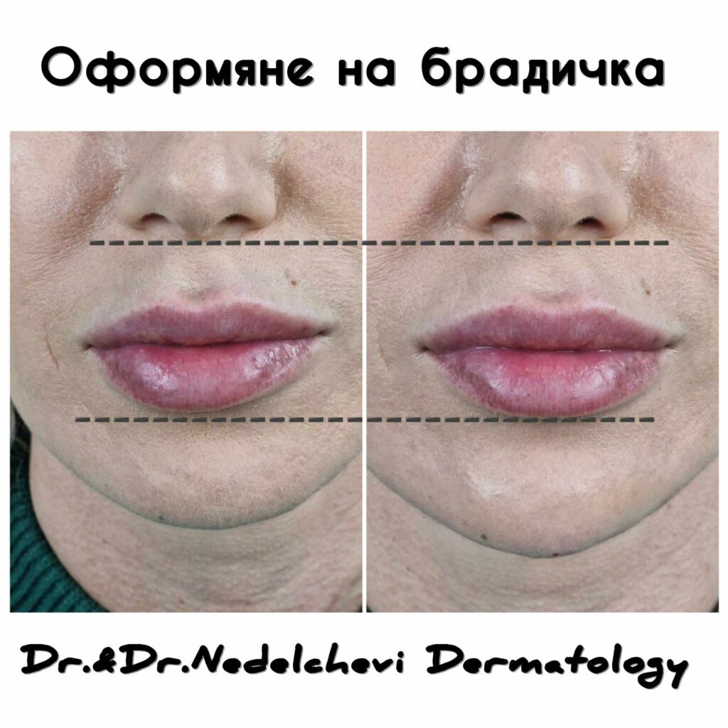 oformyane-bradichka-dr-nedelcheva-342