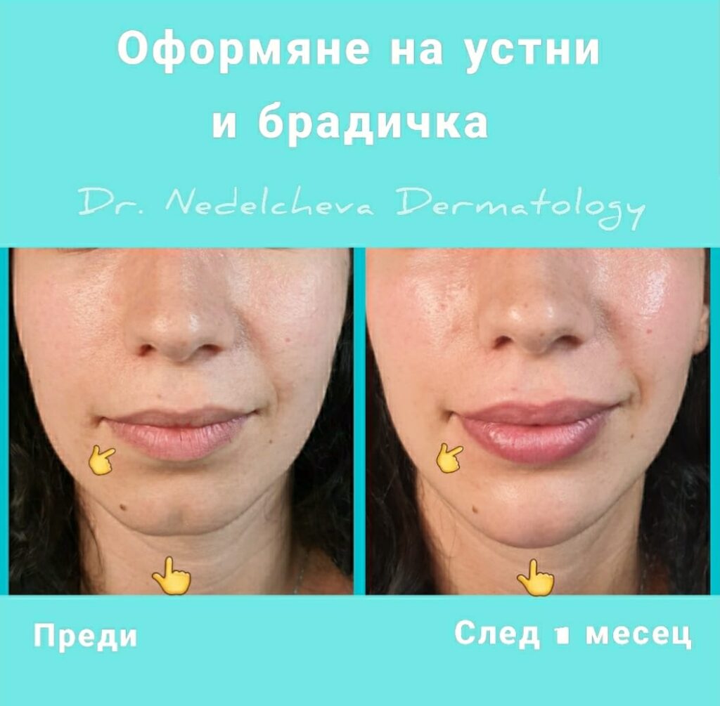 oformyane-na-bradichka2