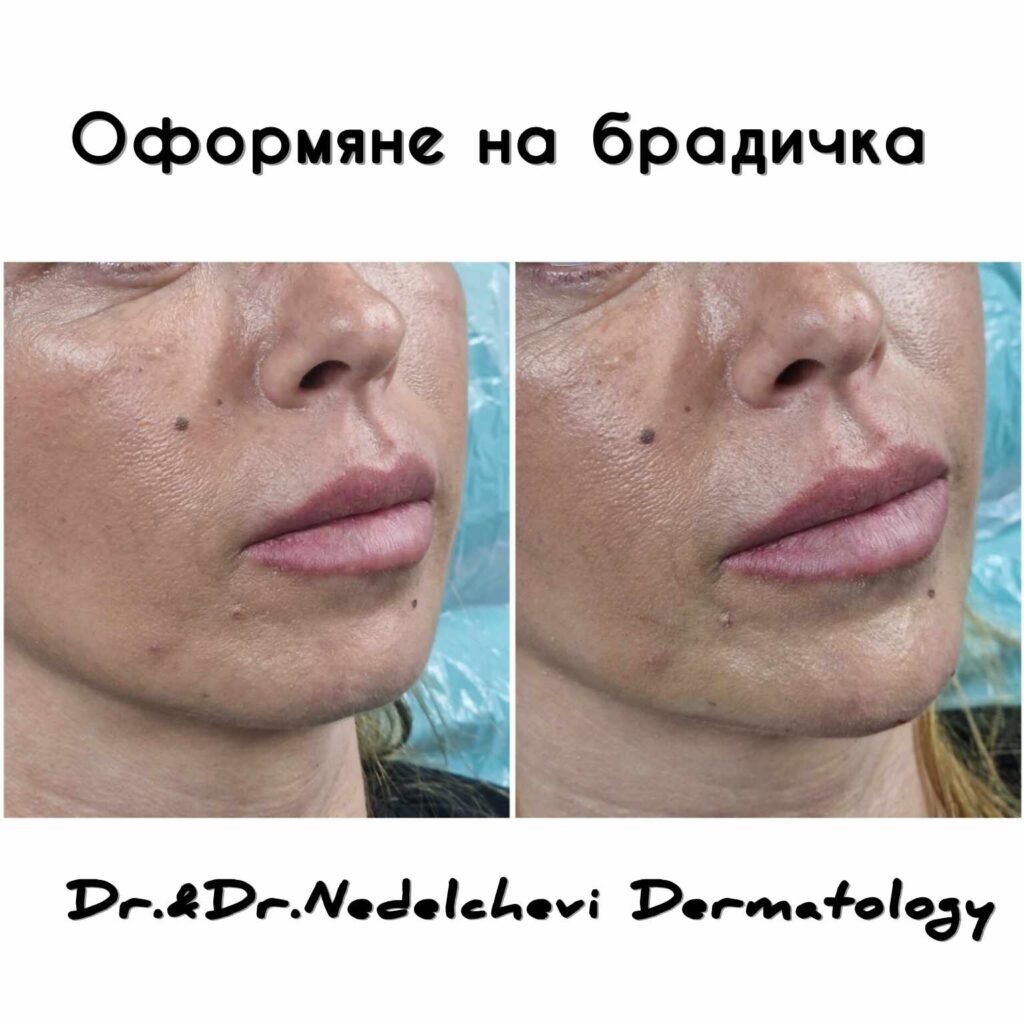 pfrmyane-bradichka-dr-nedelcheva