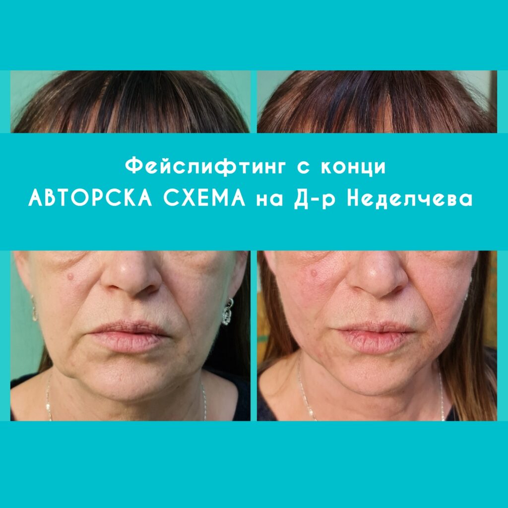 photogrid_plus_1648241410248
