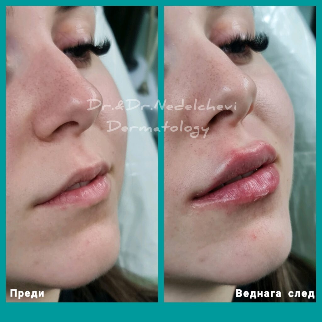 photogrid_plus_1648755711957