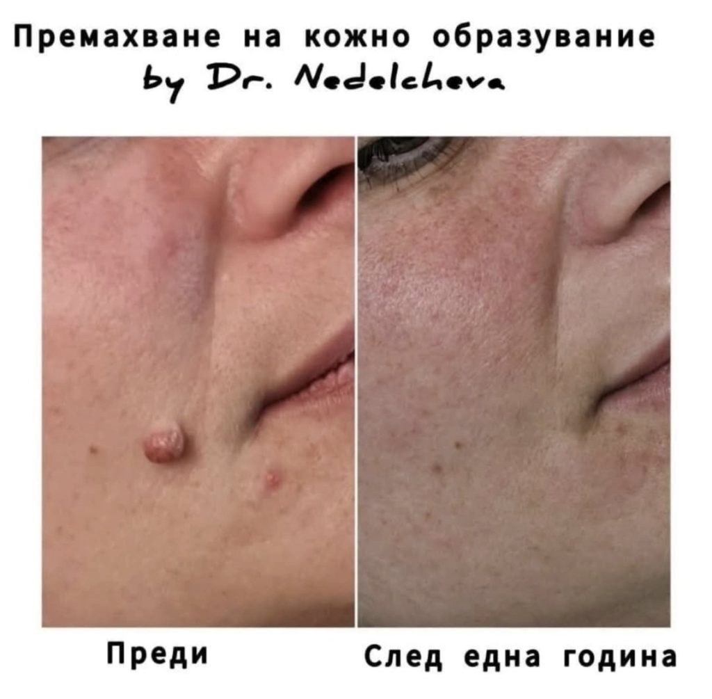 0-02-05-2123a59fb2723f7b58fc0d59358ee584832d306a6ebd1a90da1a3c74de15d89a_1f96ccb8c74fb7