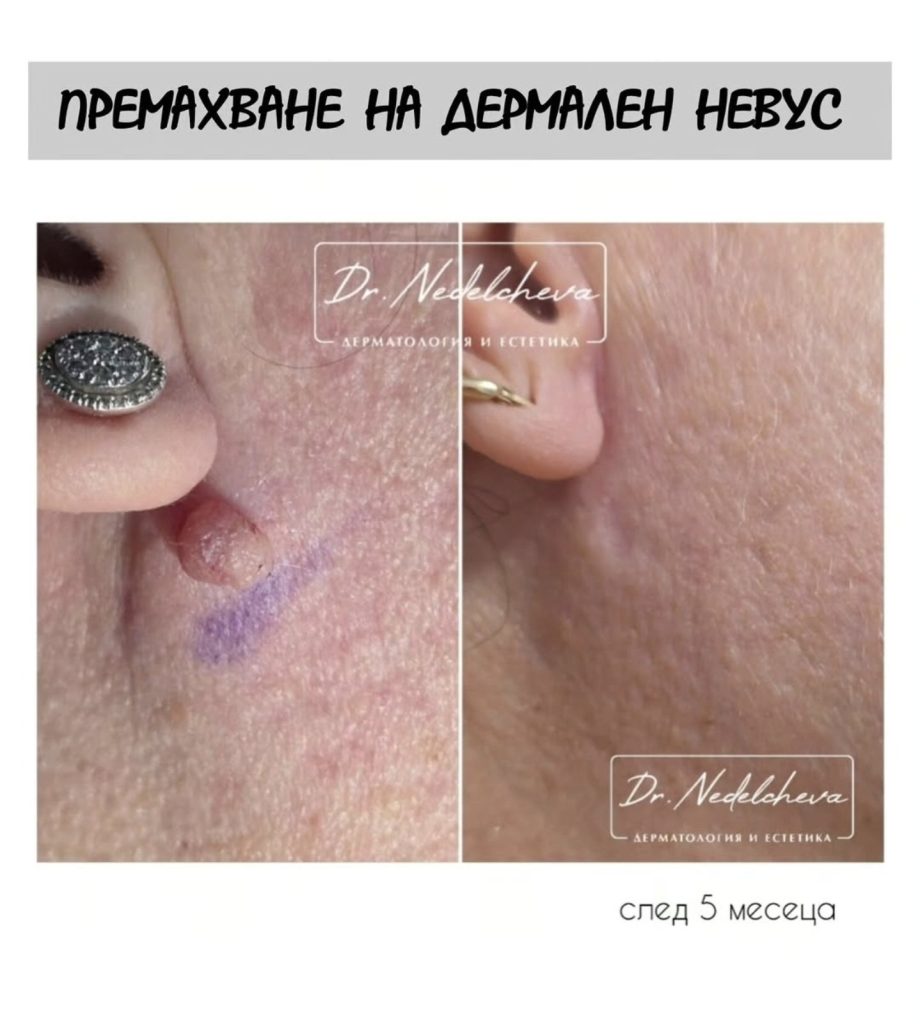 0-02-05-dbe8cd45c6503005d5798c087c4371ae23bc374e22574cf98db2525582aaf6af_1f96ccb8c5edc4